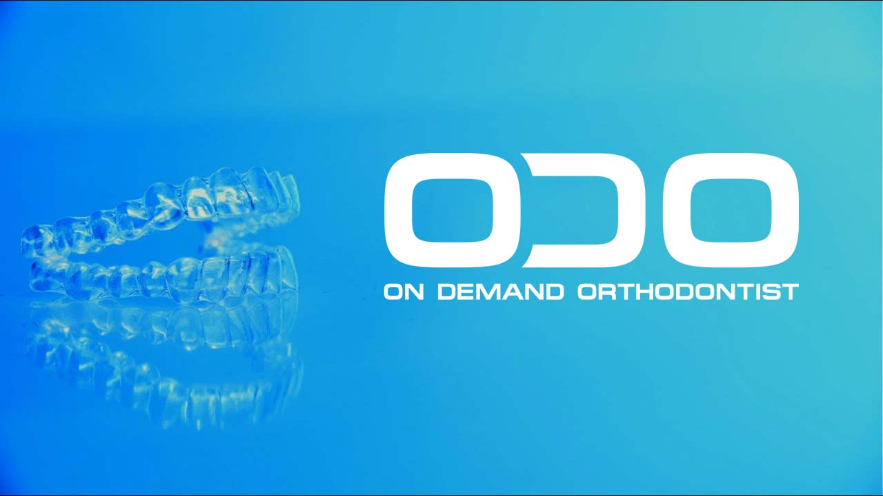 ODO Aligners